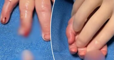 Babyâs finger allegedly severed at day care center